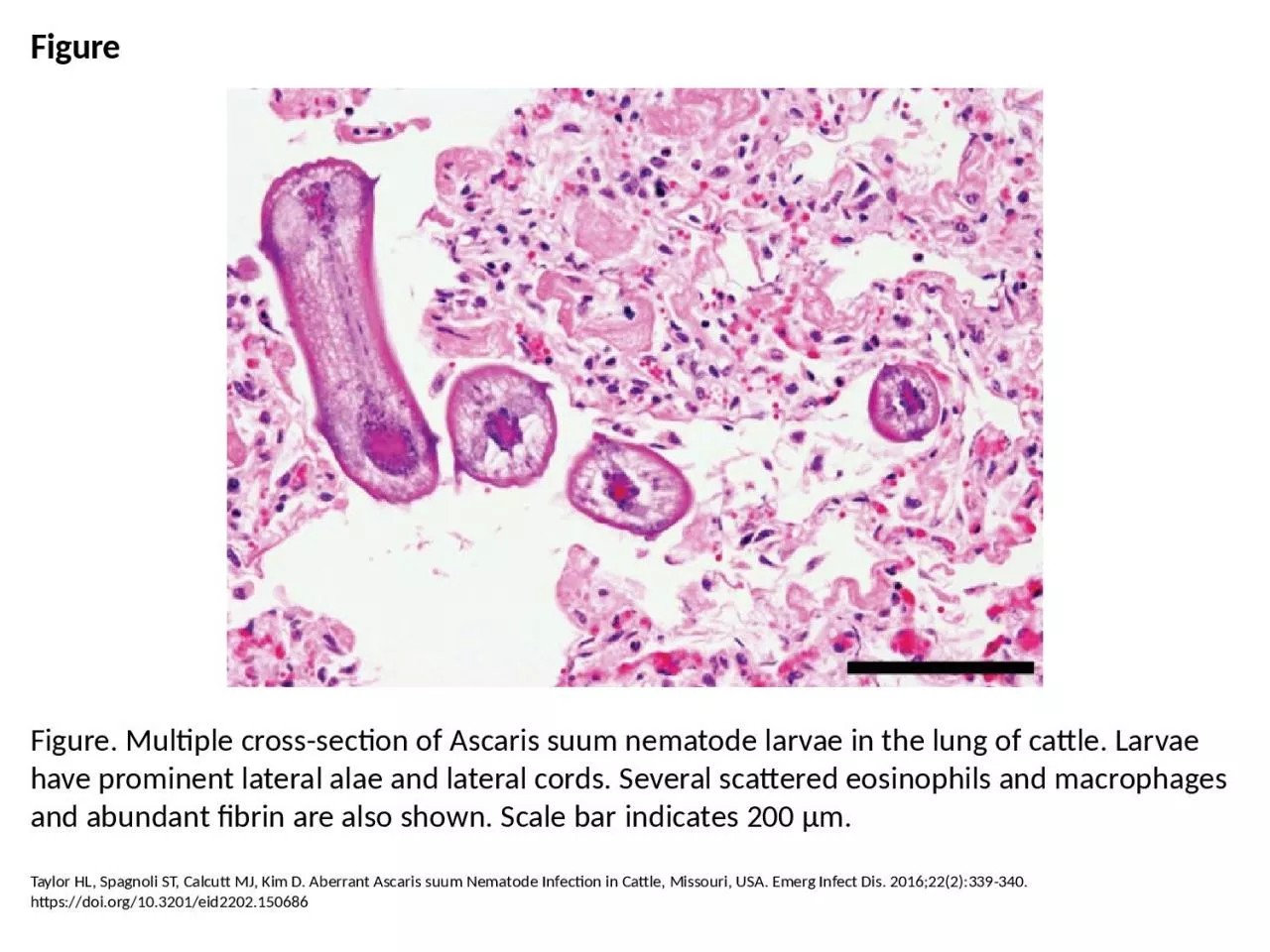 PPT-Figure Figure. Multiple cross-section of Ascaris suum nematode larvae in the lung of cattle.