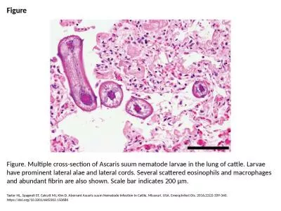 Figure Figure. Multiple cross-section of Ascaris suum nematode larvae in the lung of cattle.