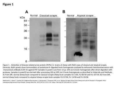 Figure 1 Figure 1. . Detection of disease-related prion protein (PrPSc) in  brains of