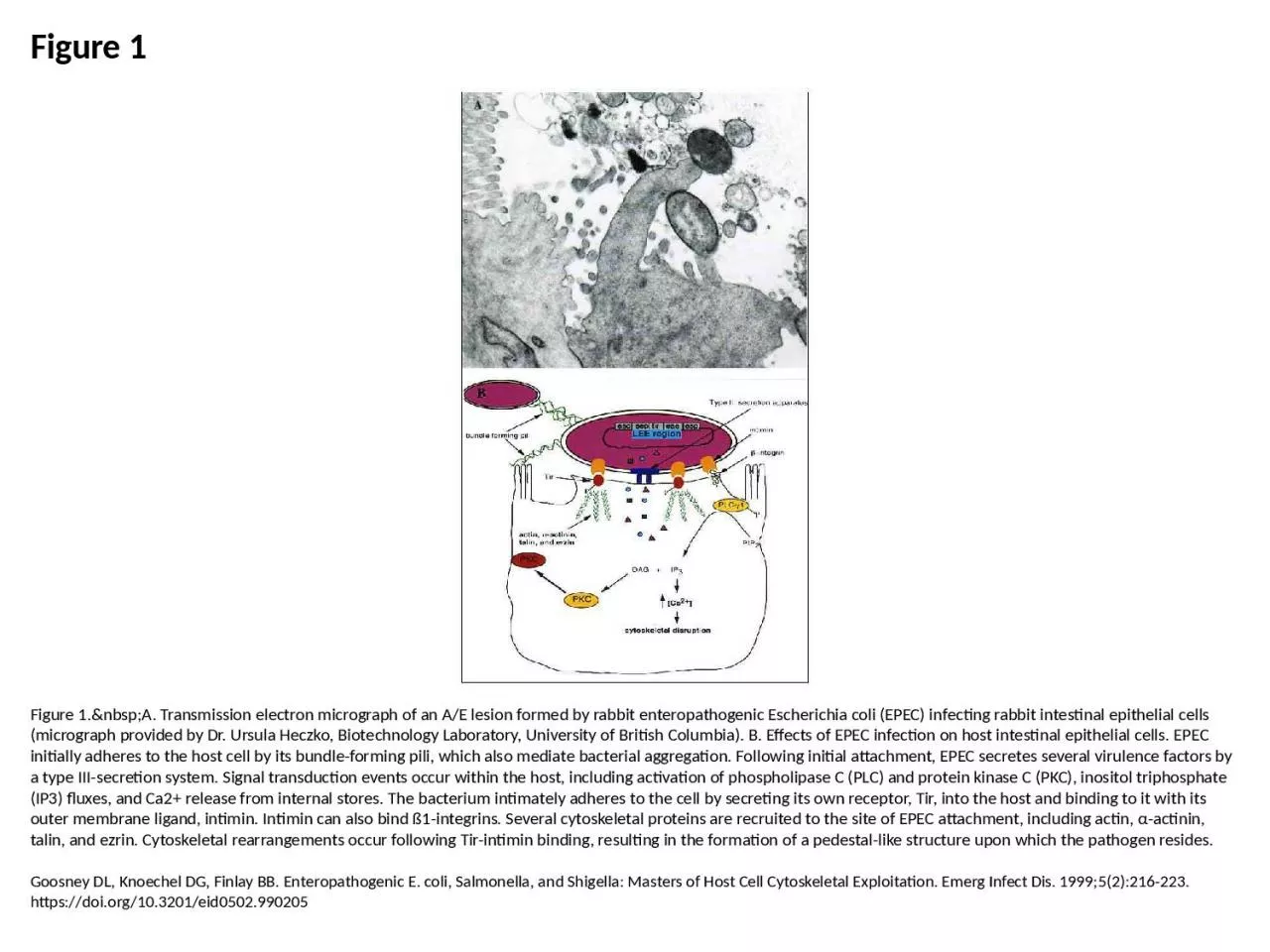 PPT-Figure 1 Figure 1.&nbsp;A. Transmission electron micrograph of an A/E lesion formed