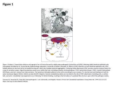 Figure 1 Figure 1.&nbsp;A. Transmission electron micrograph of an A/E lesion formed