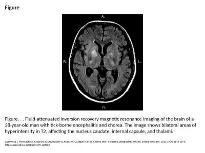 Figure Figure. . . Fluid-attenuated inversion recovery magnetic resonance imaging of the