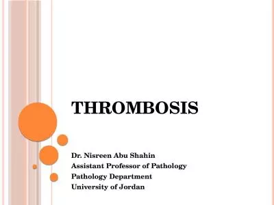 Thrombosis 	 Dr. Nisreen Abu Shahin