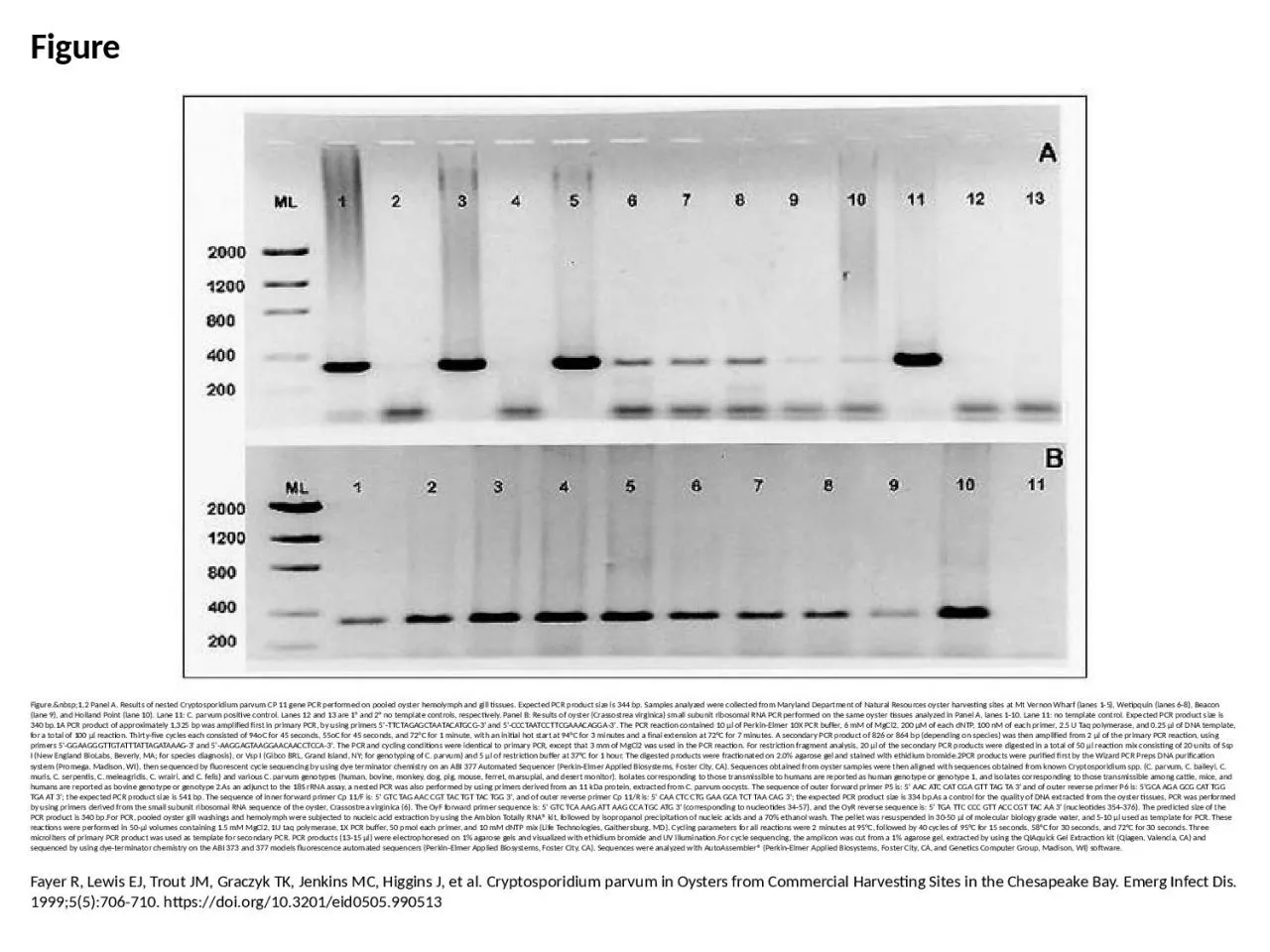 PPT-Figure Figure.&nbsp;1,2 Panel A. Results of nested Cryptosporidium parvum CP 11 gene