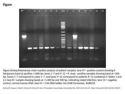 Figure Figure.&nbsp;Polymerase chain reaction analysis of patient samples: lane Pf