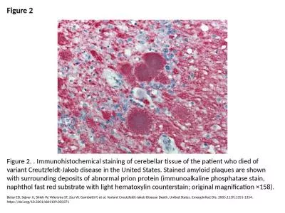 Figure 2 Figure 2. . Immunohistochemical staining of cerebellar tissue of the patient