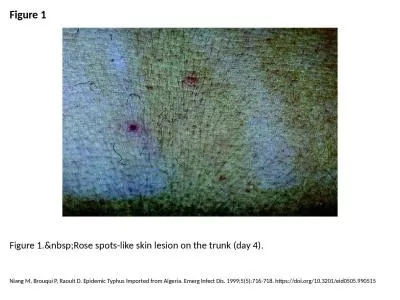 Figure 1 Figure 1.&nbsp;Rose spots-like skin lesion on the trunk (day 4).