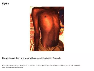 Figure Figure.&nbsp;Rash in a man with epidemic typhus in Burundi.