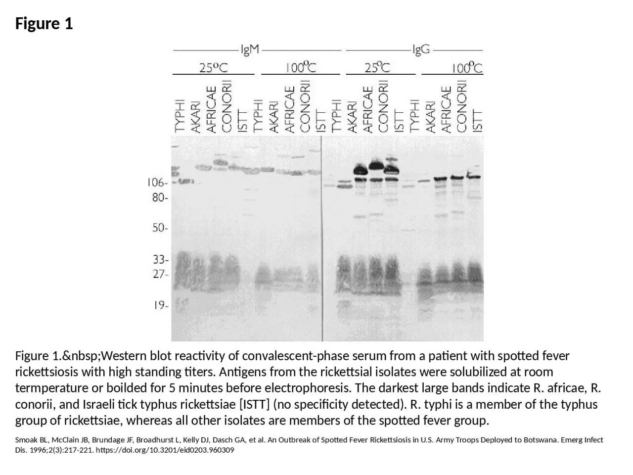 PPT-Figure 1 Figure 1.&nbsp;Western blot reactivity of convalescent-phase serum from a