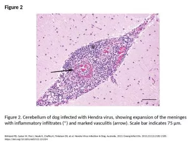 Figure 2 Figure 2. Cerebellum of dog infected with Hendra virus, showing expansion of the meninges