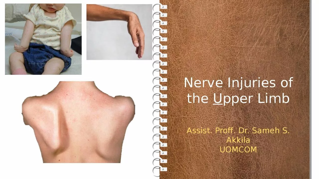Nerve Injuries of the  U