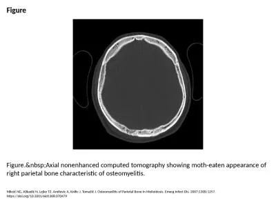 Figure Figure.&nbsp;Axial nonenhanced computed tomography showing moth-eaten appearance