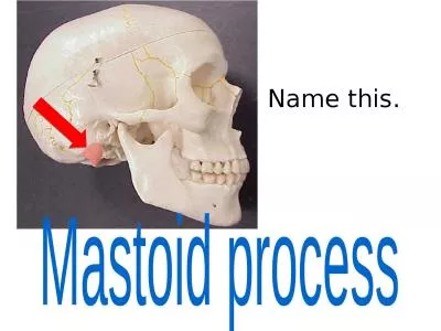 Name this. Mastoid process