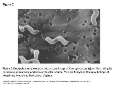 Figure 2 Figure 2.&nbsp;Scanning electron microscope image of Campylobacter jejuni,